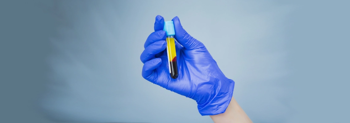 Плазмотерапия ПРП РегенЛаб (PRP RegenLab) в клинике GEN87